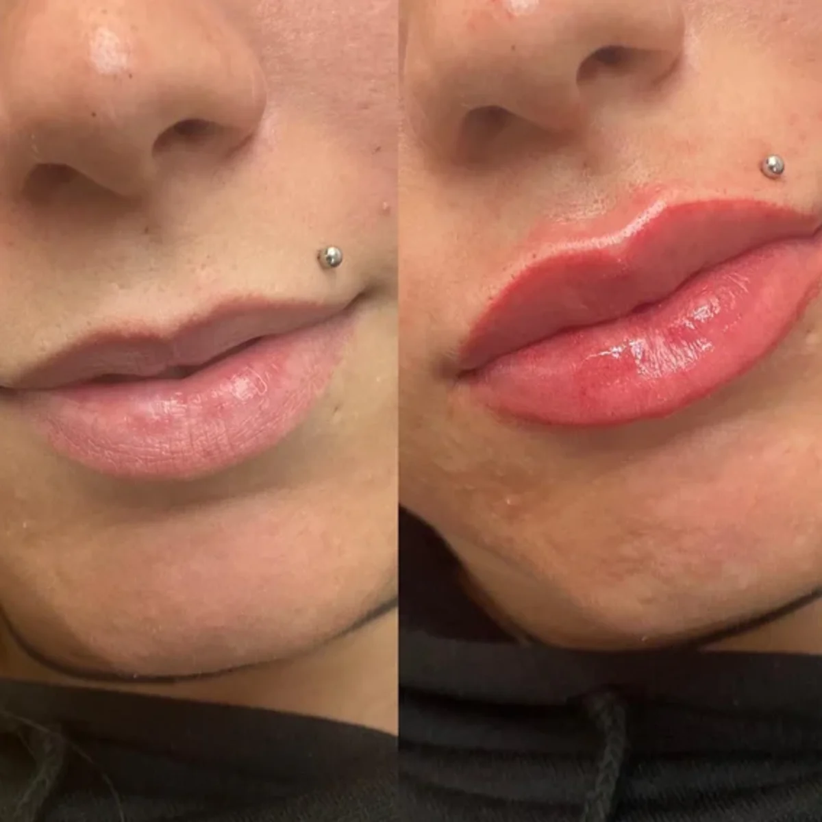 Cosmetic Tattooing Lips